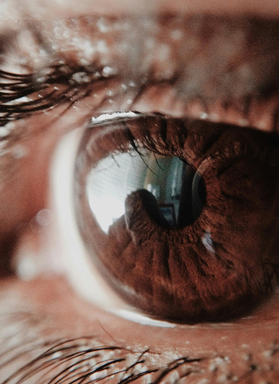 Okluzija Centralne Vene slika